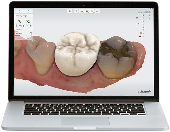 Dental Design Software